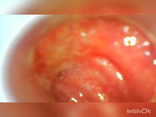 Usb endoscope 80 cm profond anal insertion, adulte film d2