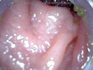 Anal Endoscope Part 1, Free Enema Punishment HD dirty video 04