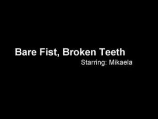 Bare 拳头 broken 牙齿 - cruel 和 deadly 危险.